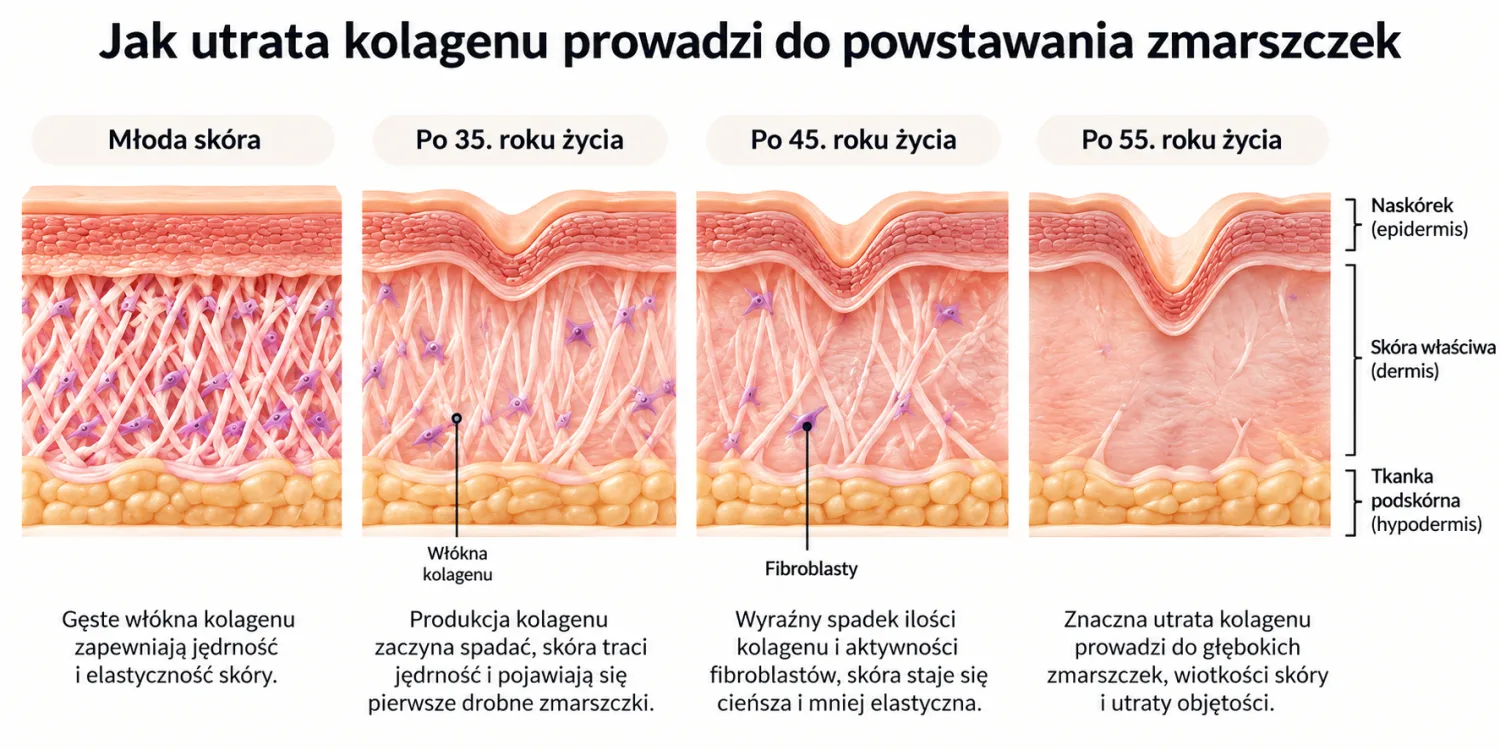 Ilustracja przedstawiająca warstwy skóry i włókna kolagenowe